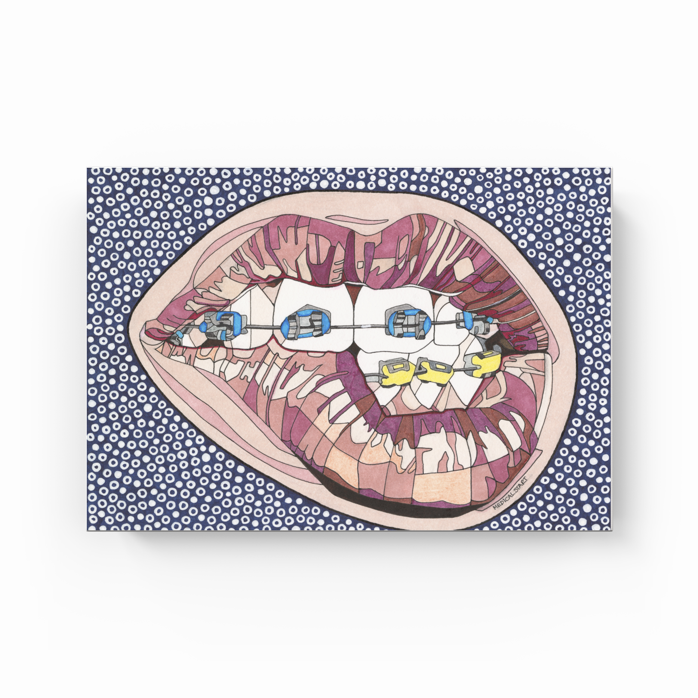 dental braces - Kanvas Tablo