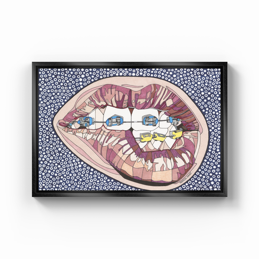 dental braces - Canvas Print