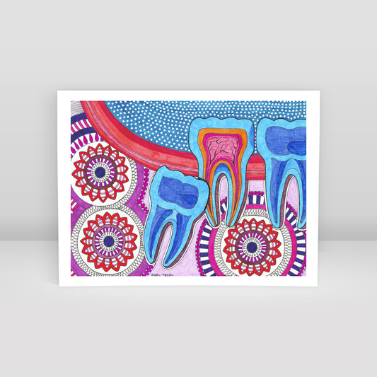 recessed wisdom tooth - Art Print