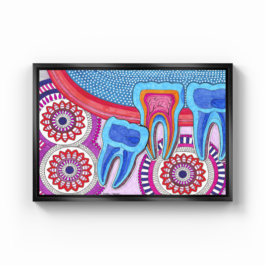 recessed wisdom tooth - Canvas Print