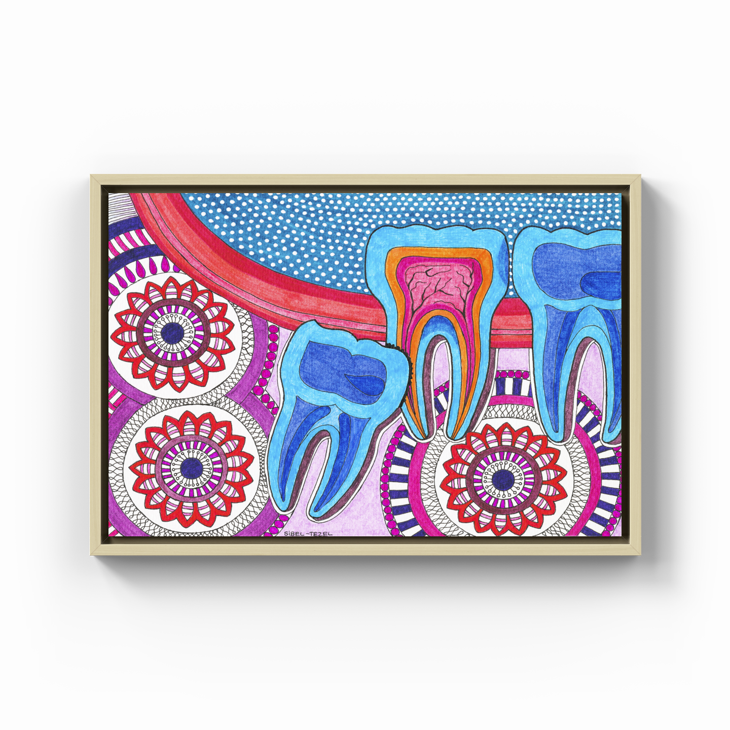 recessed wisdom tooth - Kanvas Tablo