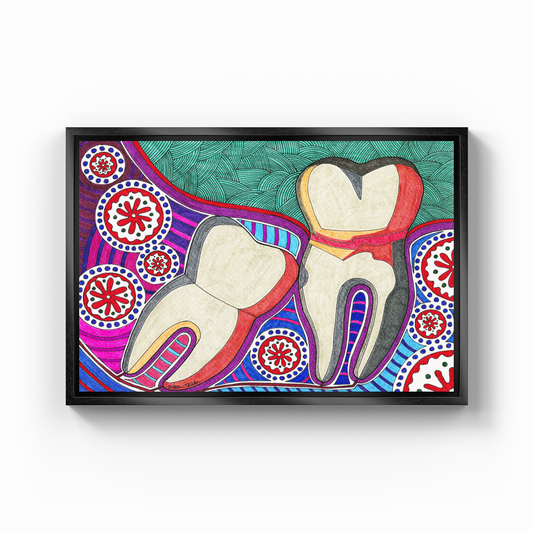 wisdom tooth - Canvas Print