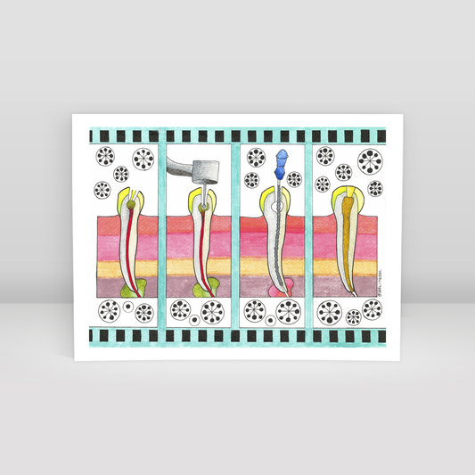 canal treatment - Art Print