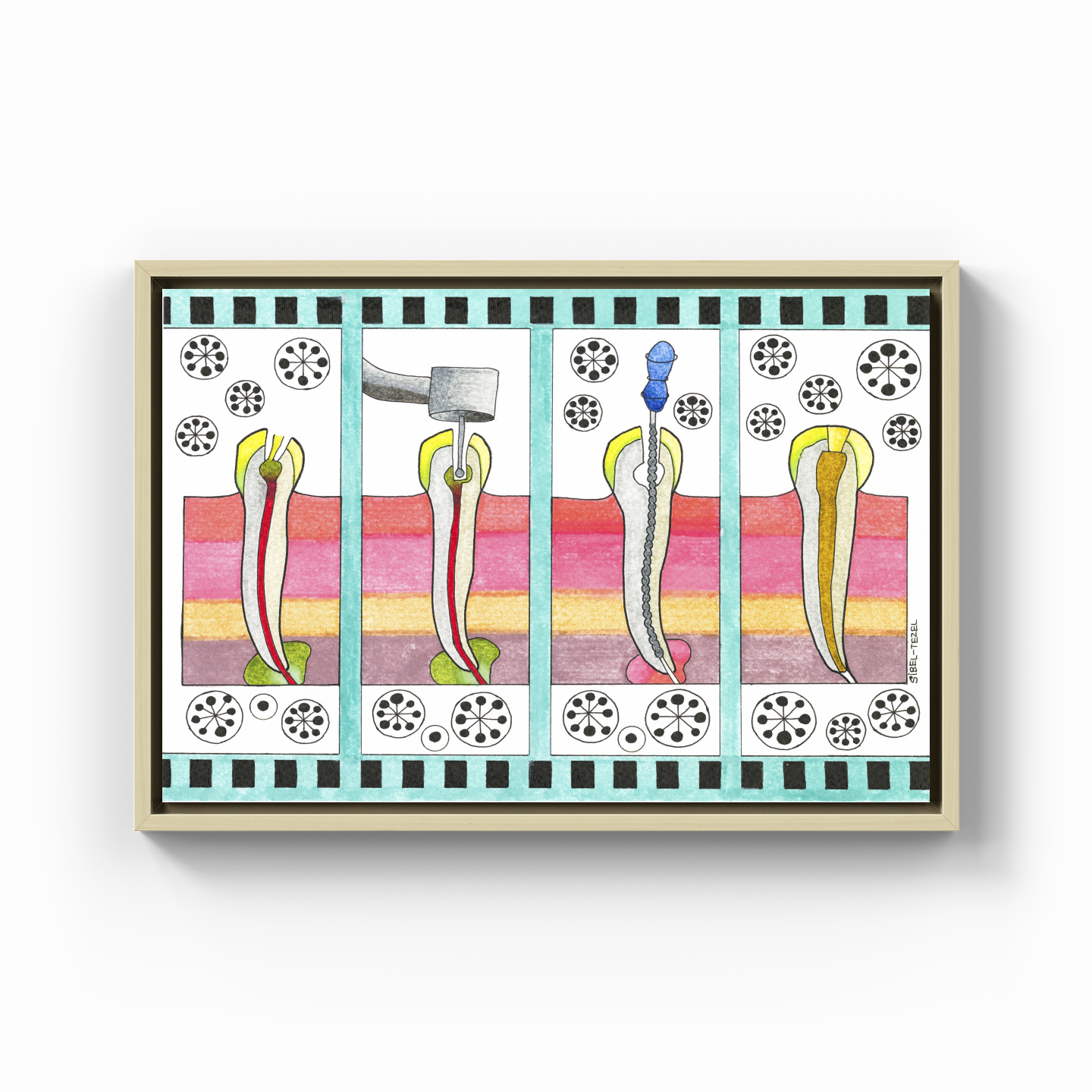 canal treatment - Canvas Print