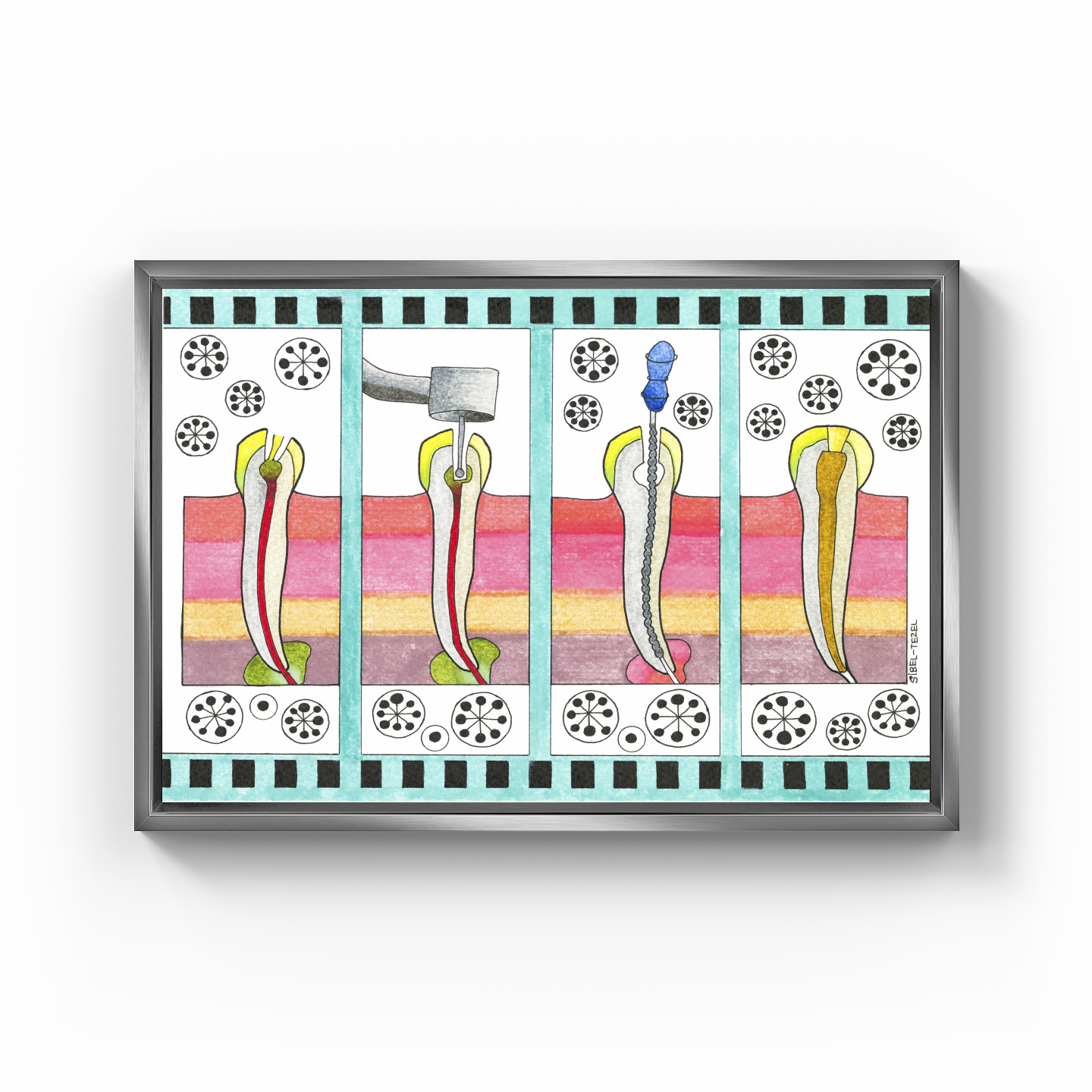 canal treatment - Canvas Print