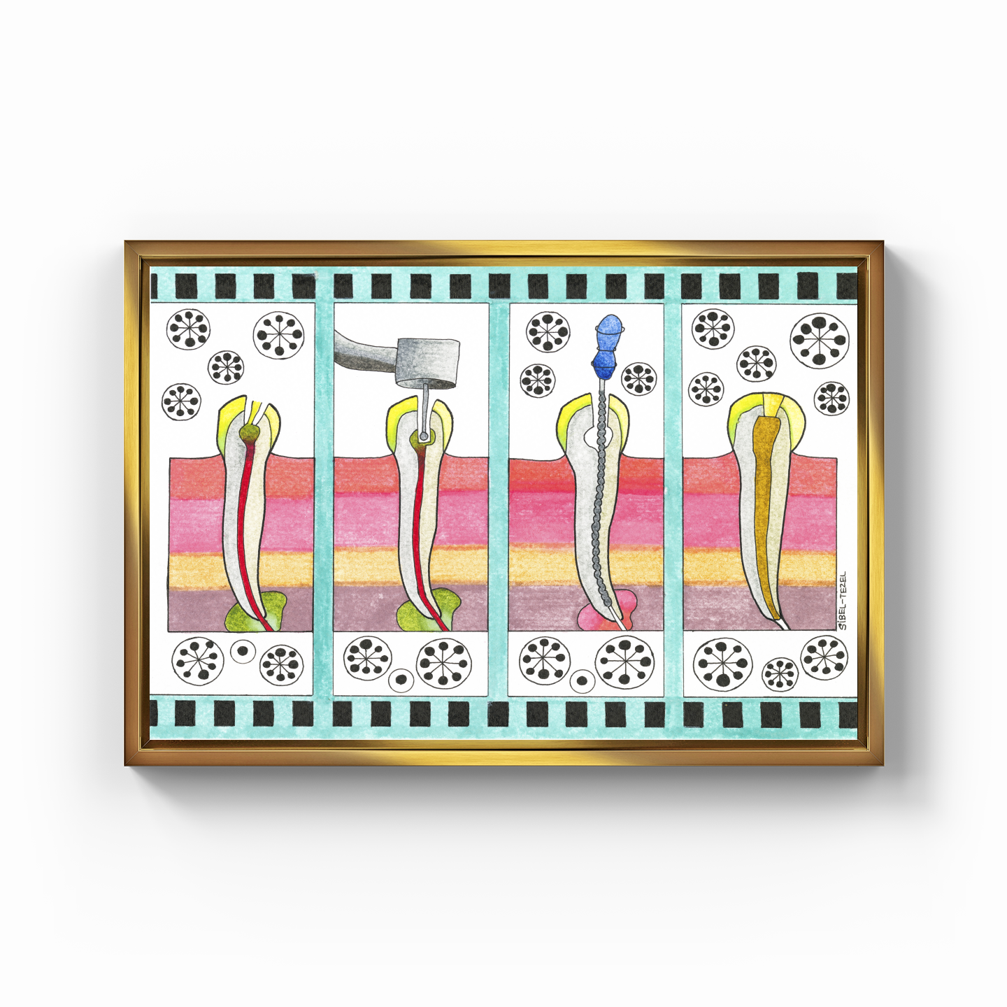 canal treatment - Canvas Print