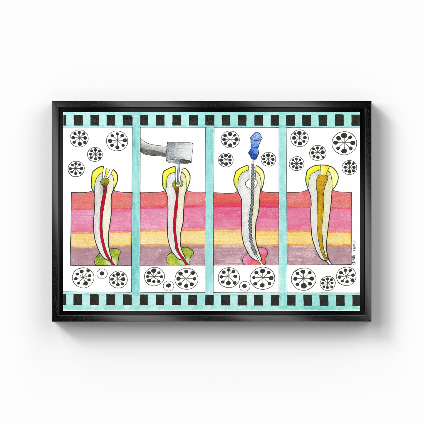 canal treatment - Canvas Print