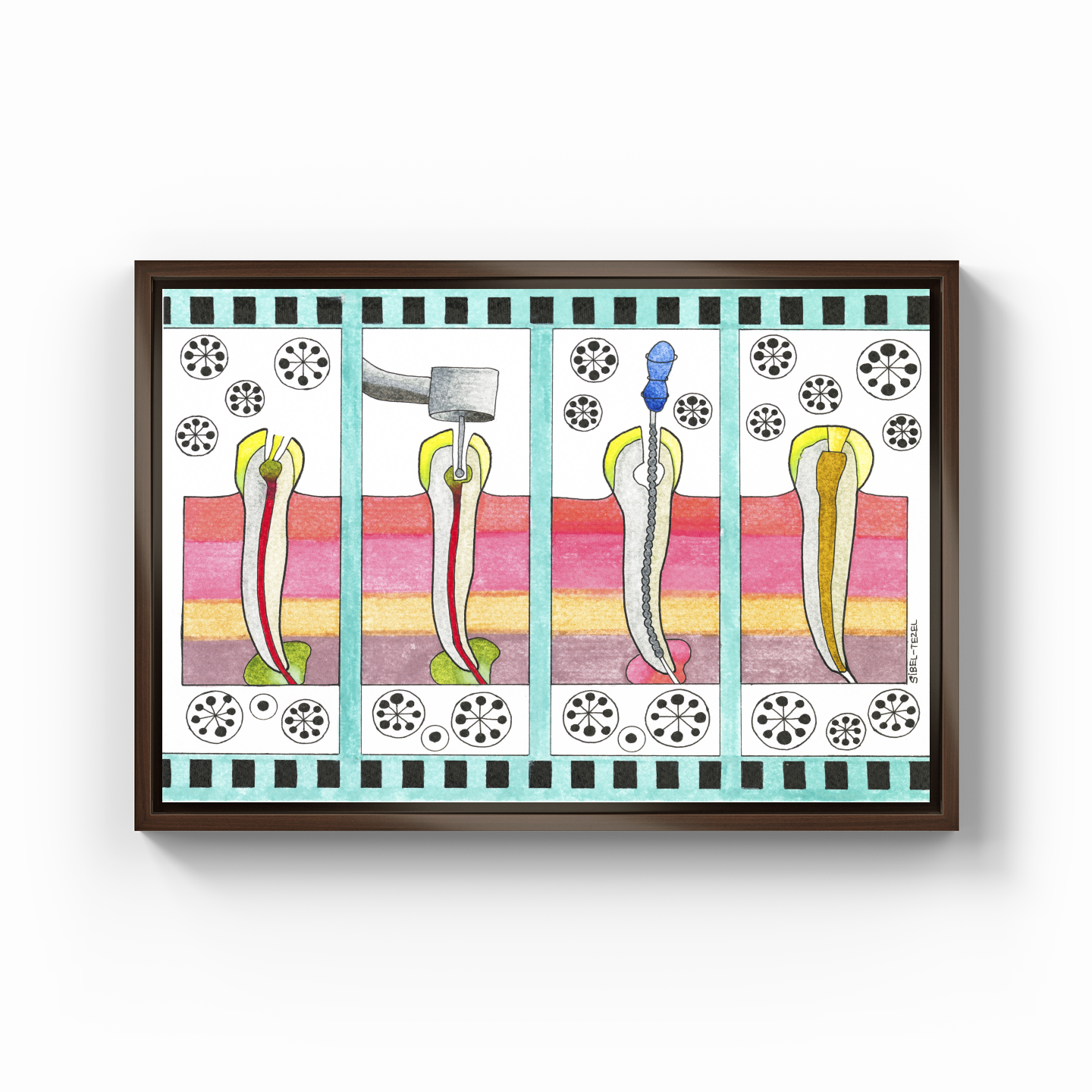 canal treatment - Canvas Print