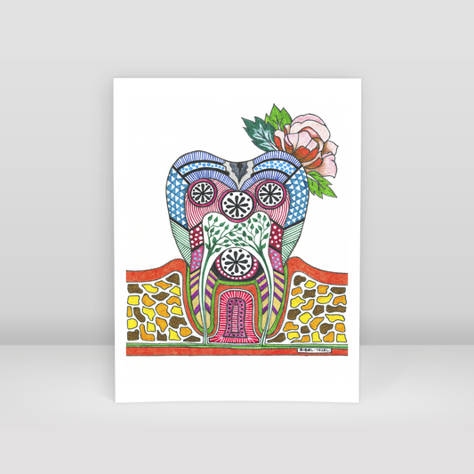 caries tooth - Art Print