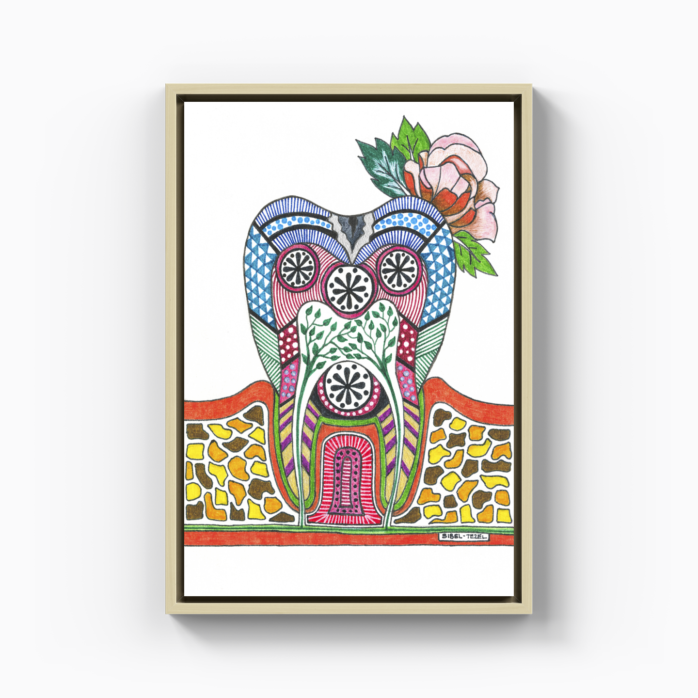 caries tooth - Kanvas Tablo