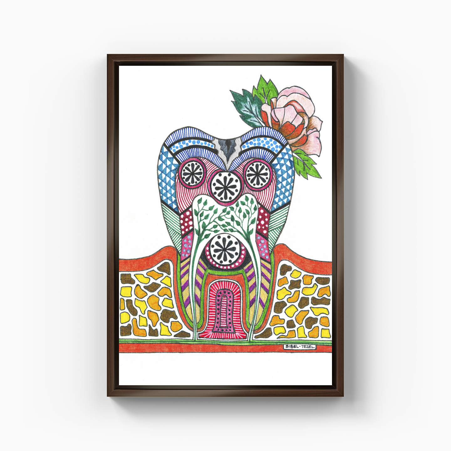 caries tooth - Kanvas Tablo