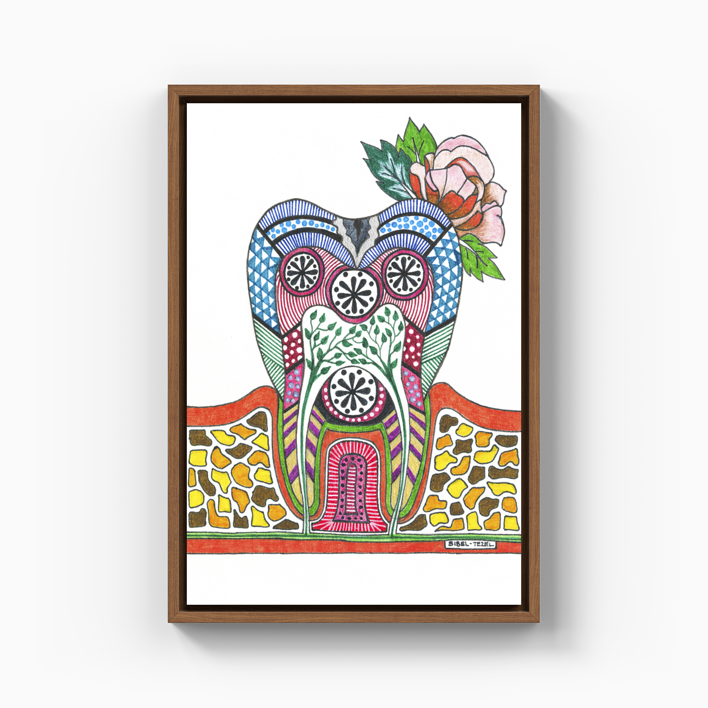 caries tooth - Kanvas Tablo