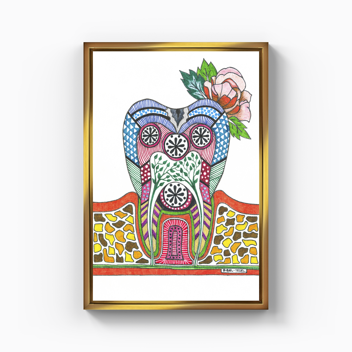 caries tooth - Kanvas Tablo