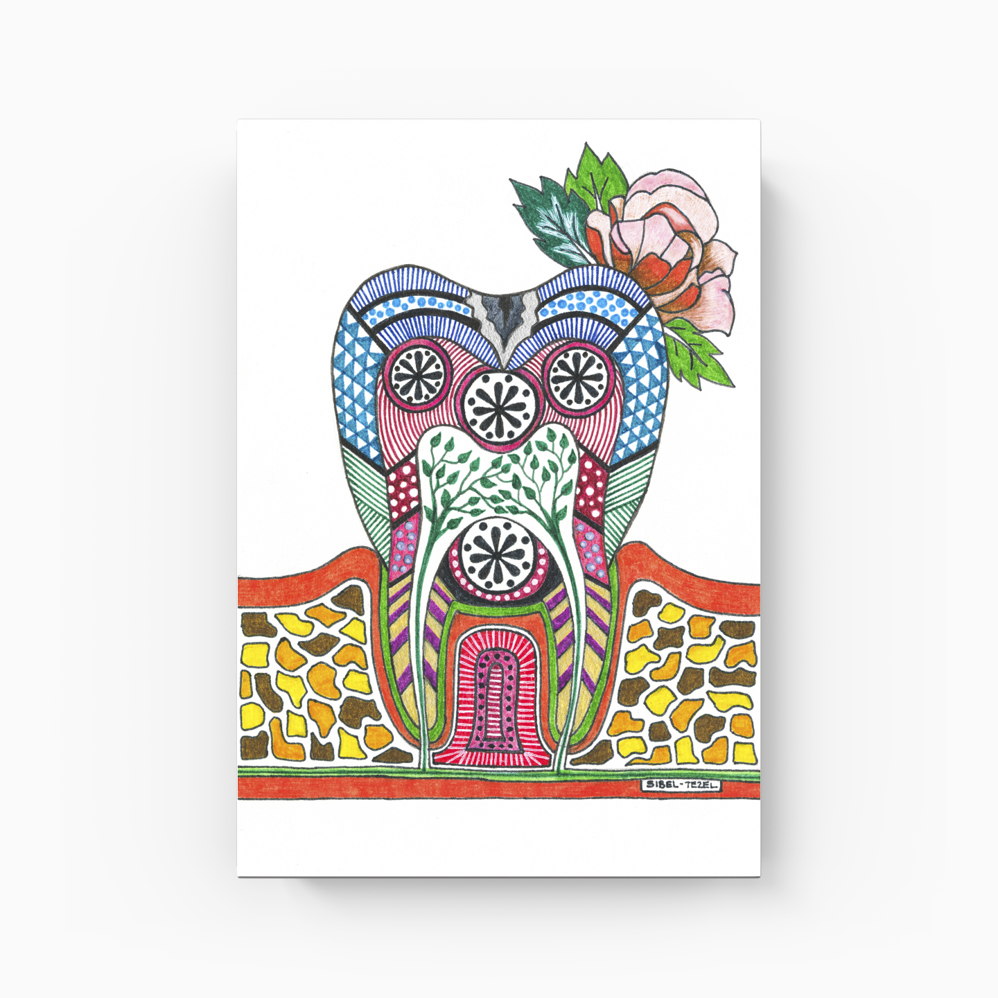 caries tooth - Kanvas Tablo