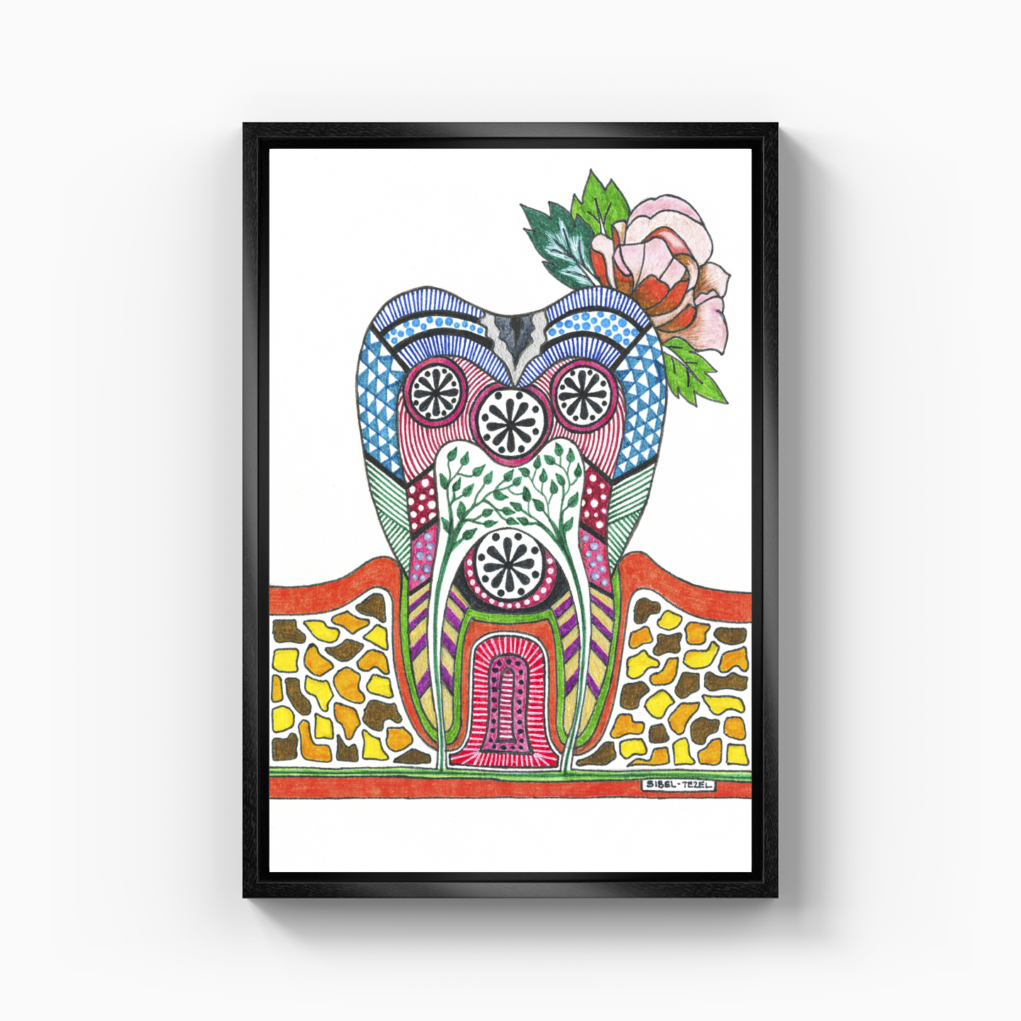 caries tooth - Kanvas Tablo