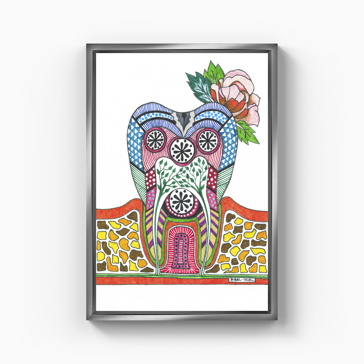 caries tooth - Kanvas Tablo