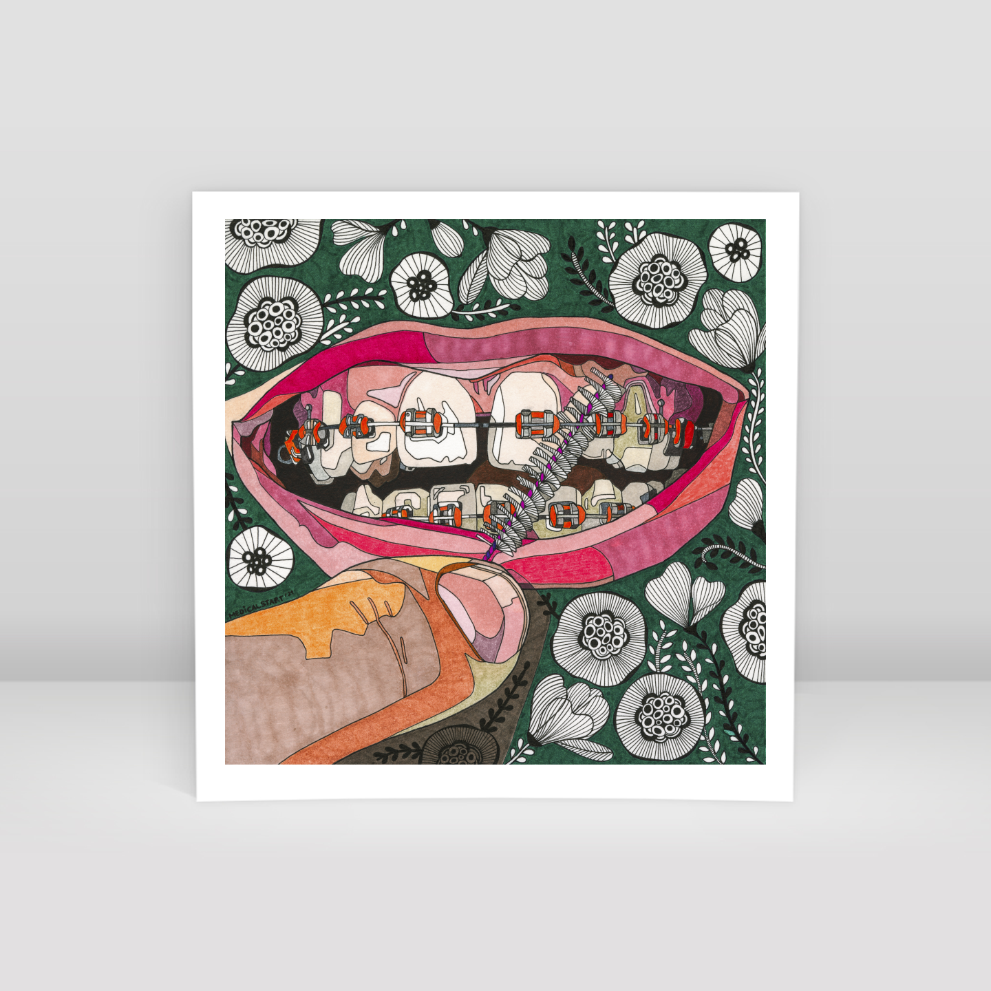 oral care in orthodontia - Art Print
