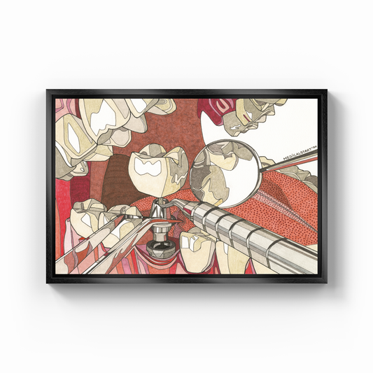 implant supported fixed partial denture - Canvas Print