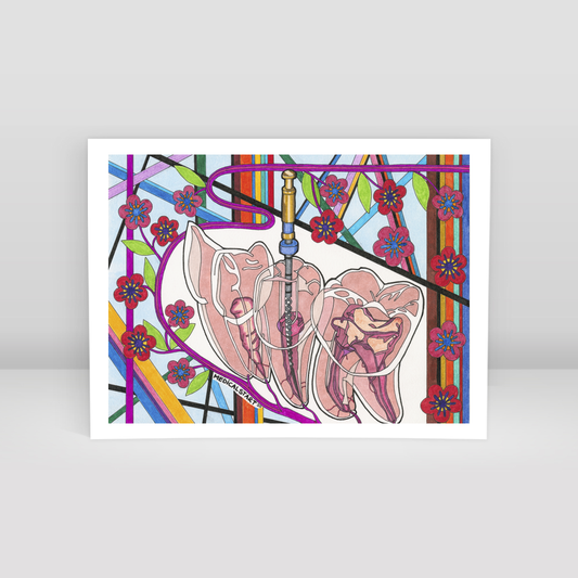 endodontics (canal treatment) - Art Print