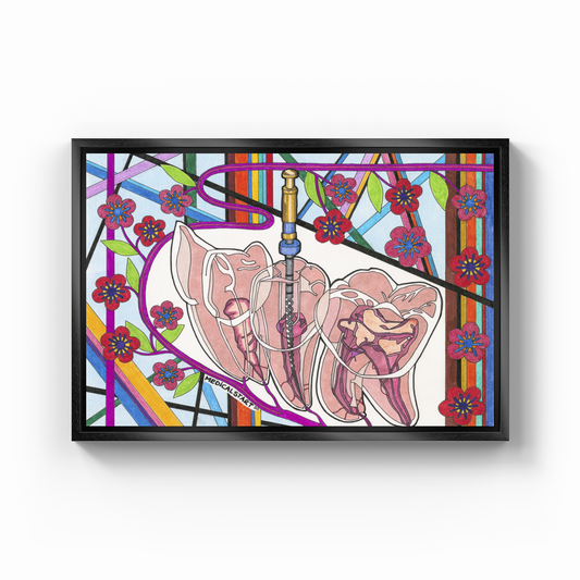 endodontics (canal treatment) - Canvas Print