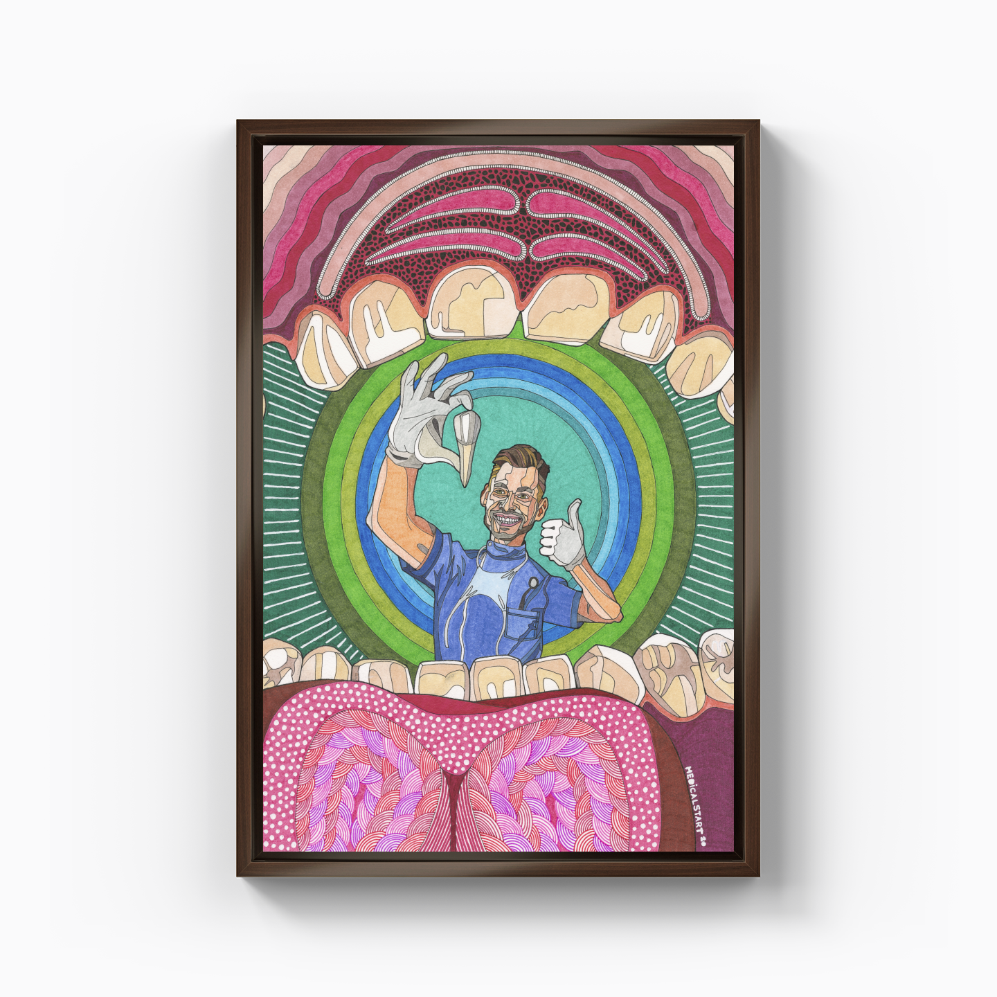 maximillar premolar tooth extraction - Kanvas Tablo