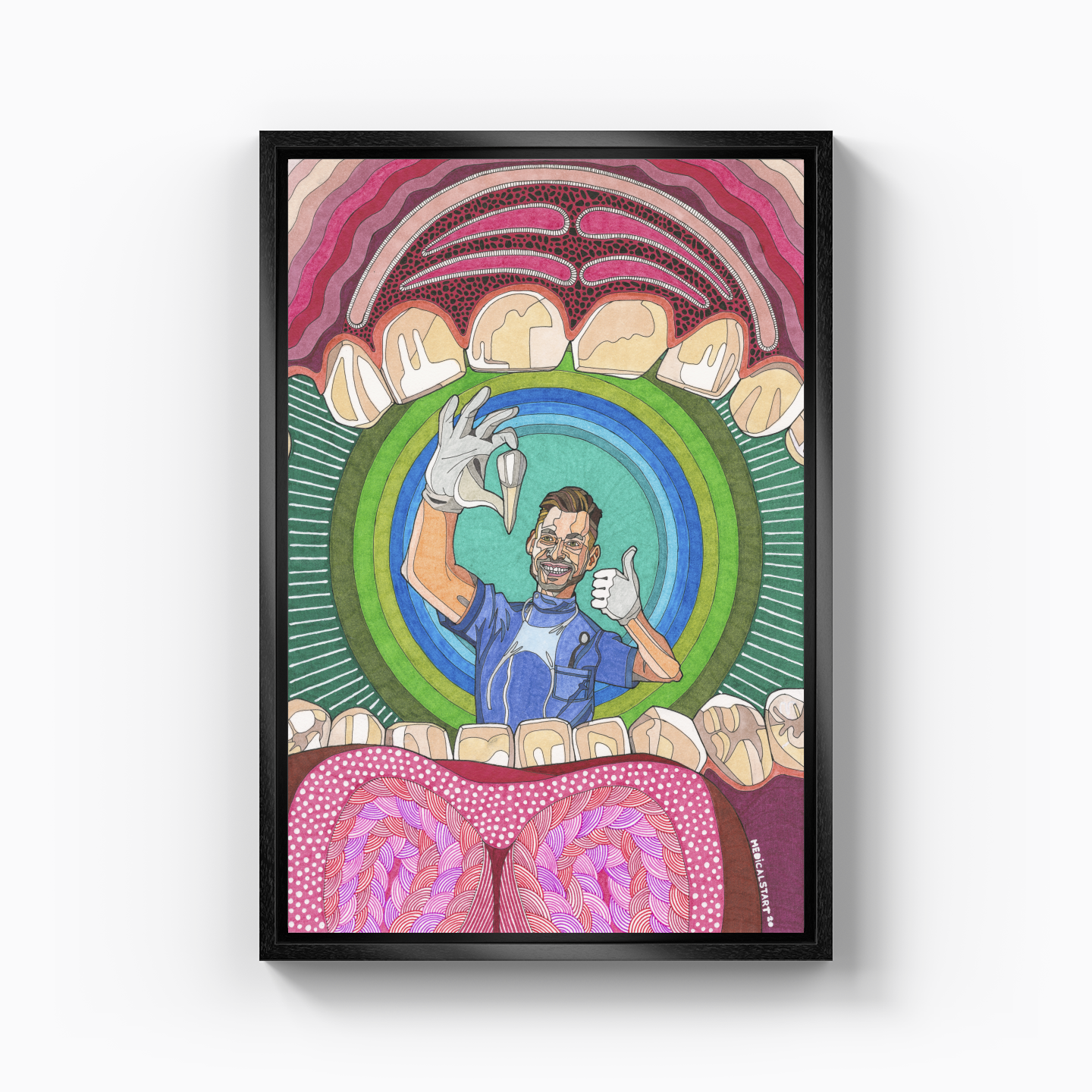 maximillar premolar tooth extraction - Kanvas Tablo