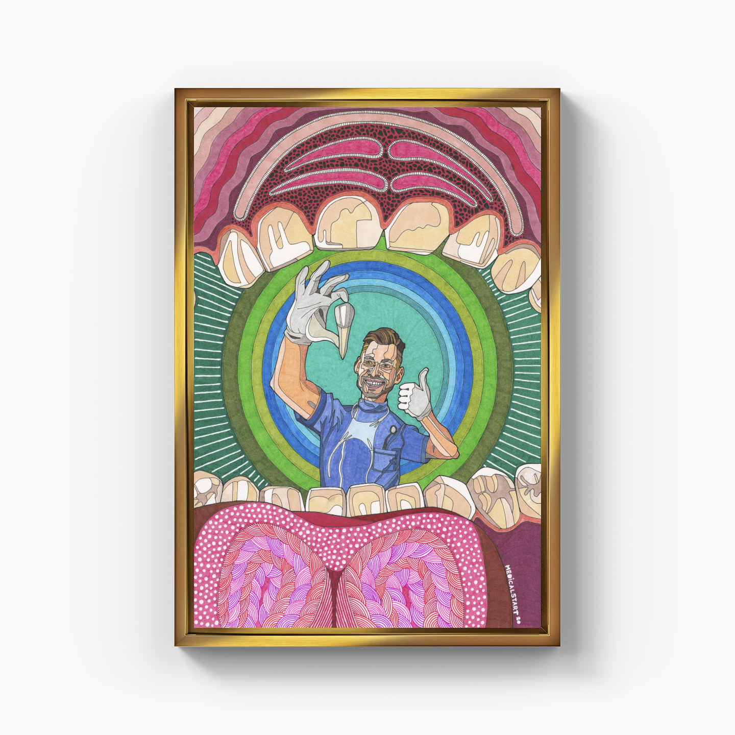 maximillar premolar tooth extraction - Kanvas Tablo