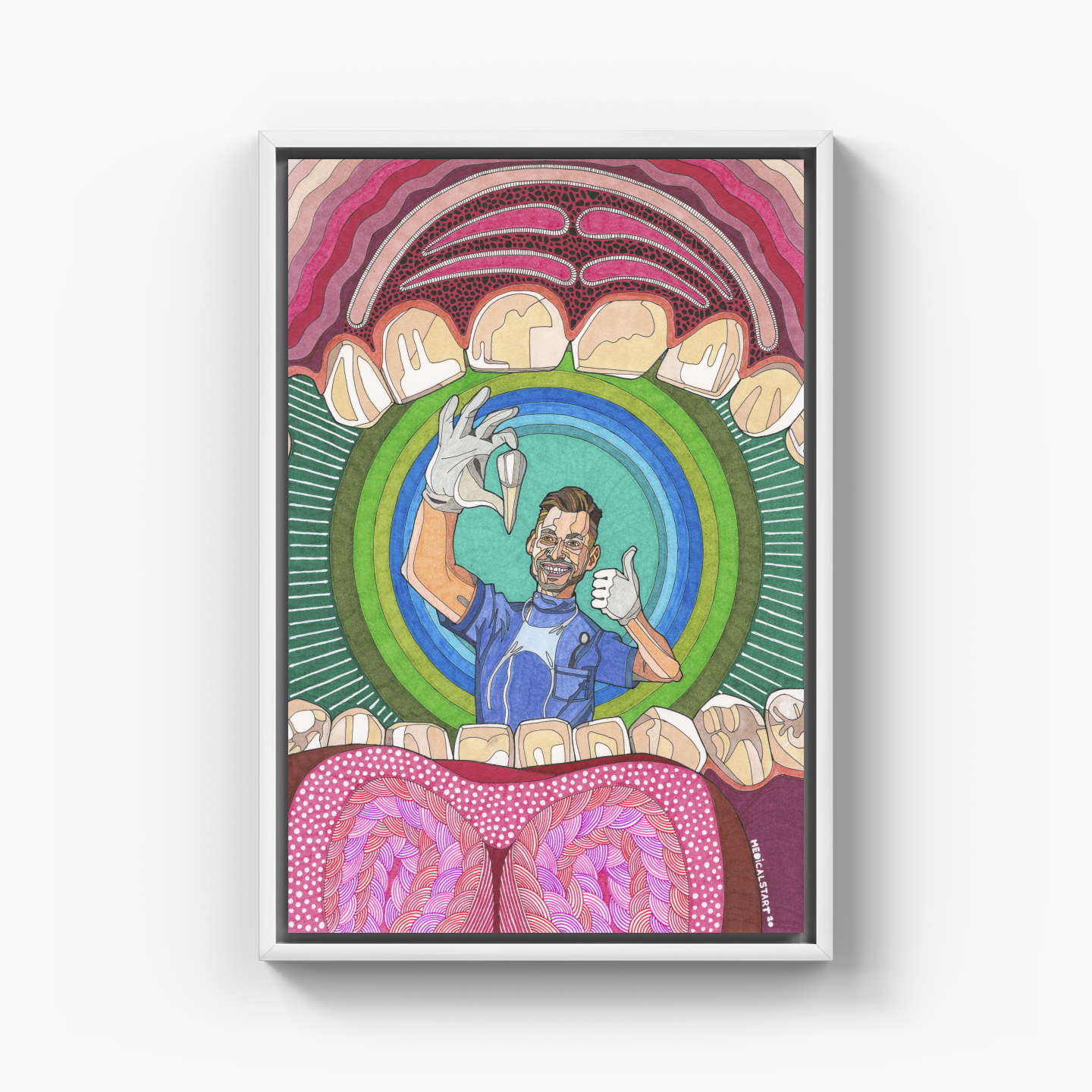 maximillar premolar tooth extraction - Kanvas Tablo